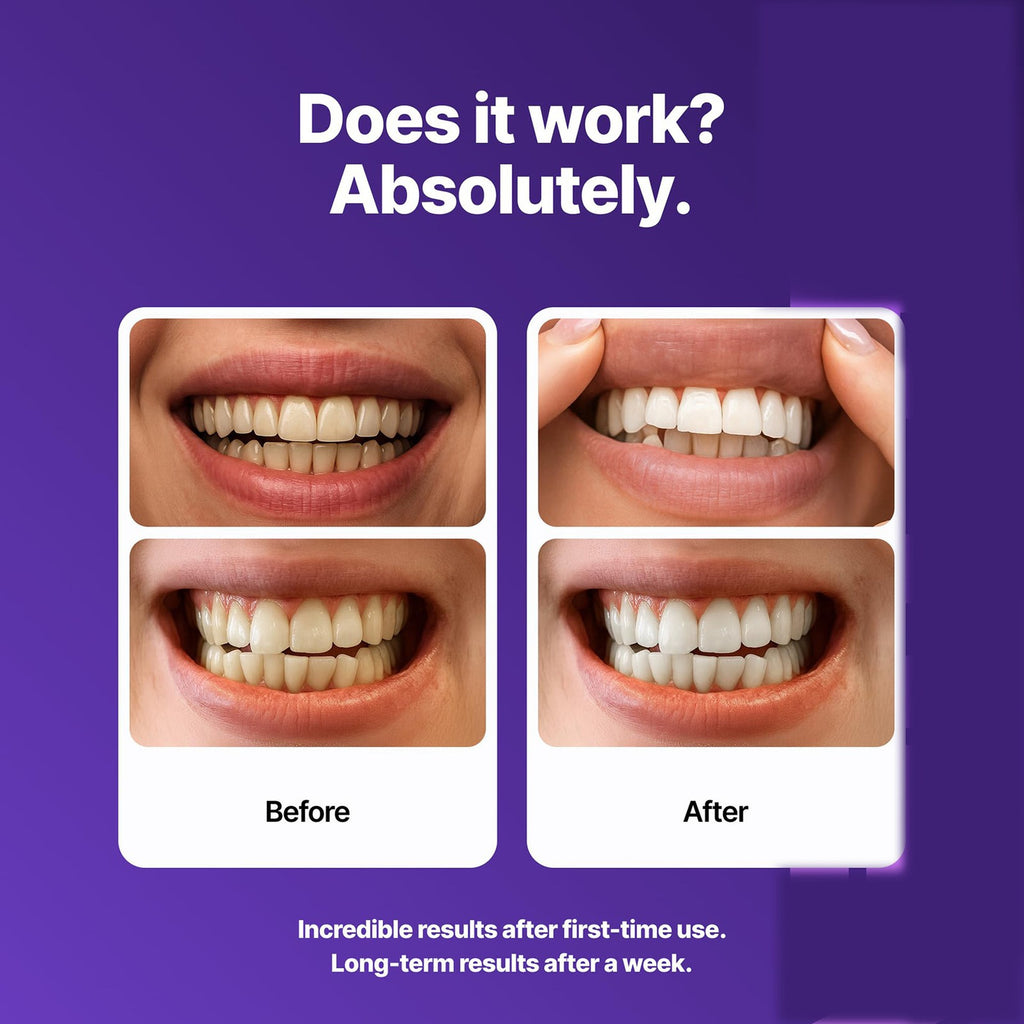 Transform Your Smile with Non-Toxic Enamel-Safe Teeth Whitening Strips - 14 Fast-Acting Strips for a Brighter, Confident You!